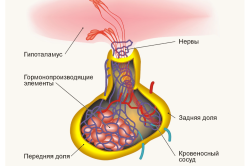Заболевания гипофиза - причина высокого диастолического давления