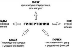 Последствия гипертонии