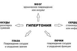 Влияние гипертонии на остальные органы